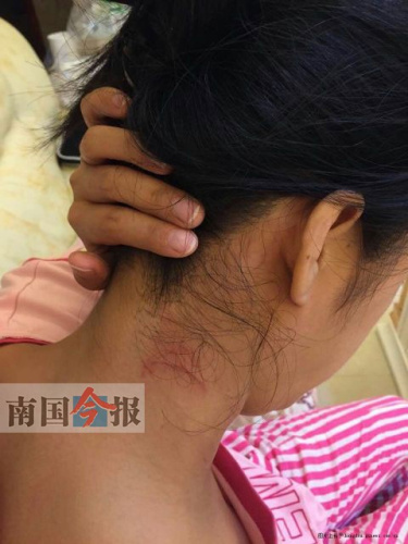 广西三女子赴宴遭官员猥亵1人反抗被暴打