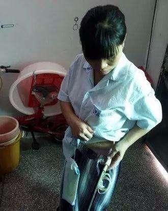 出院近一个月,身上还挂着药水袋